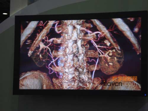 裸眼高清3D立體顯示